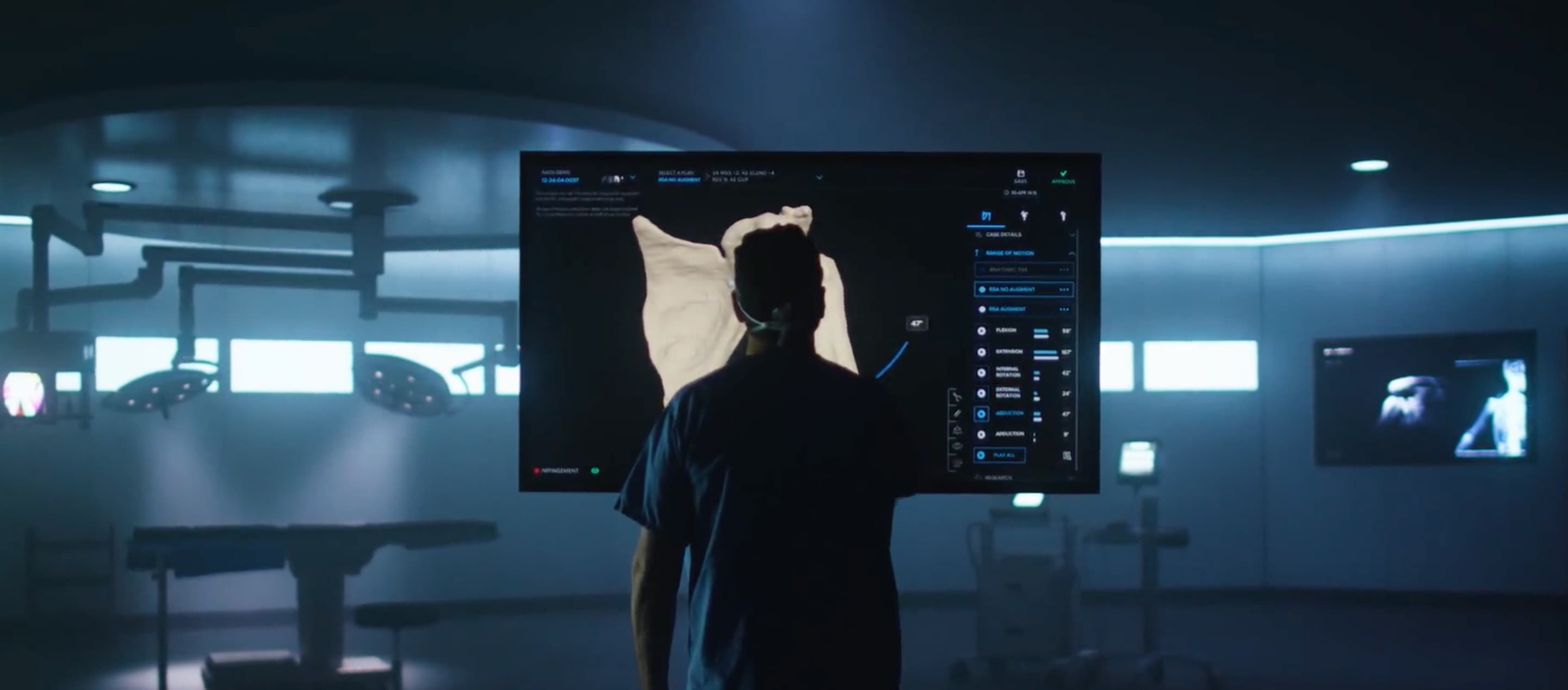 Arthrex Product Design